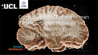 BrainMap: Correlative HiP-CT of the human brain to bridge histology and radiology