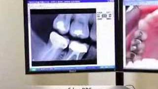 Digital X-Rays, Benefits of this technology