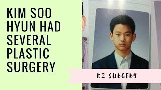 Kim Soo Hyun Had Several Plastic Surgery