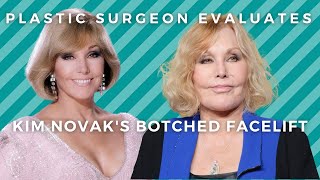 Kim Novak's Botched Facelift: Plastic Surgeon Reacts