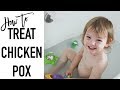 How to treat chicken pox | CHICKEN POX REMEDIES