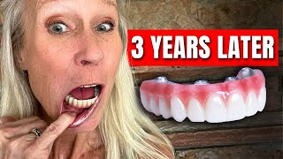 I Was TERRIFIED of Dental Implants... My Honest Experience