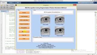 Matlab code for Iris Recognition using Image Processing Matlab Project with Source Code