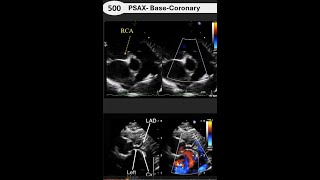 Pediatric Echo Full Protocol