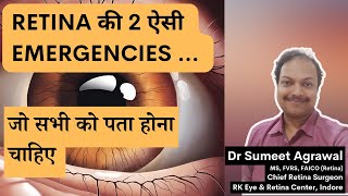 RETINA की 2 EMERGENCIES जो सभी को पता होना चाहिए l