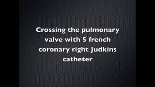 Pulmonary valvuloplasty