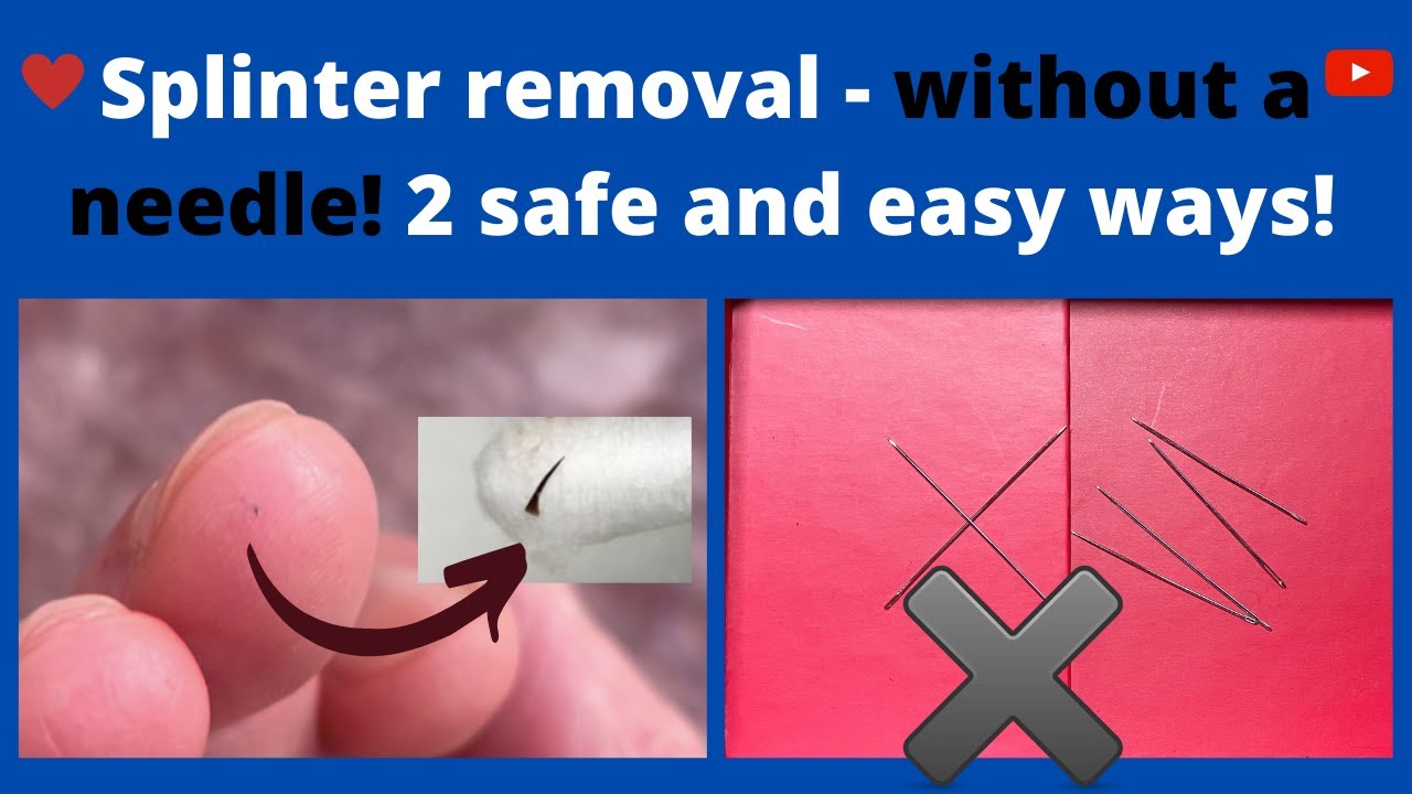 Finger Still Hurts After Removing Splinter At Ruth Townsend Blog