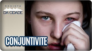 Conjuntivite: Sintomas, Tratamento e Prevenção - Revista da Cidade (16/08/2017)