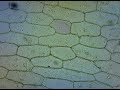 red onion plasmolysis and cytolysis