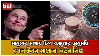 মানুষের মাথায় বসানো হচ্ছে ডিভাইস, ব্রেইন নিয়ন্ত্রণ করবে আরেকজন | Human Brain Chips | Elon Musk