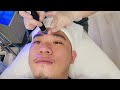 林小牛帶著媽媽去醫美 皮秒雷射picocare u0026海菲秀hydrafacial vlog