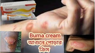 Burna cream আগুনে পোড়ার ক্রিম বার্না ক্রিম পোড়ার ক্ষতে ব্যাকটেরিয়ার সংক্রমণে প্রতিরোধক দেহের