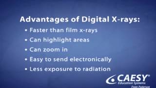 Advantages of Digital X-Ray