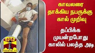 காவலரை தாக்கிய நபருக்கு  கால் முறிவு: தப்பிக்க முயன்றபோது காலில் பலத்த அடி