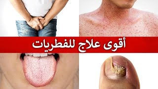 العلاج الاقوى على الاطلاق للفطريات (الكانديدا أو المبيضات)