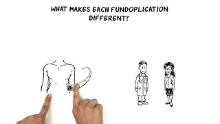 What Makes Each Fundoplication Different