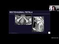 imaging of obstetrical and gynecologic post operative complications