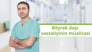 Böyrək daşı xəstəliyinin müalicəsi