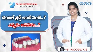 డెంటల్‌ బ్రిడ్జ్‌ అంటే ఏంటి..? | Dental Bridges Explained | Ocean International Dental Hospitals