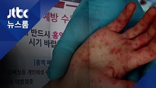 경산서 알제리 유학생 '홍역' 확진…\