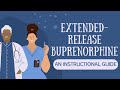 Extended-Release Buprenorphine: An Instructional Guide