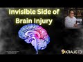 Concussions Uncovered: The Invisible Aftermath of Brain Trauma | Kraus TBI Institute, Houston TX