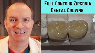 Close up look at 2 zirconia crowns