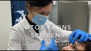 Botox behandeling frons spieren door dokter Yulia bij Art de la Beauté