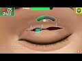 চোখ কিভাবে অপারেশন করে দেখুন। how is eye surgery done viral cartoon 3danimation পর্ব ৩