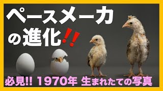 ペースメーカの歴史と進歩　心電図