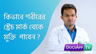 কিভাবে  শরীরের স্ট্রেচ মার্ক  থেকে মুক্তি  পাবেন?  #AsktheDoctor