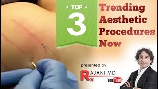 #3 Trending Aesthetic Treatments NOW