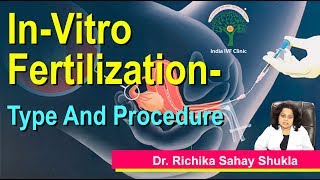 Types of IVF - In-Vitro Fertilization- Its Type and Procedure