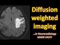 Diffusion Weighted Imaging (DWI) in Neuroradiology... made easy!