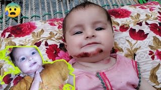 Abeera Ke Halat Ab Khatre se Bahar🤲 | Baby injured 😰 | doughter injured |@HafeezullahVlogs