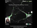 visualizing mitochondrial trafficking in neurons with nanolive imaging