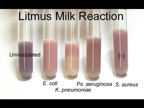 Litmus Milk Test - Amrita University - YouTube