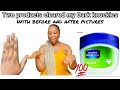 Two simple products cleared my dark knuckles,dark pigmentations regardless of the years of damage💯