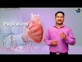 symptoms of hypertension in tamil இரத்த கொதிப்பின் அறிகுறிகள் pstamil