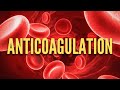 How To Anticoagulate Patients In The Hospital (The Only Video You Need!)