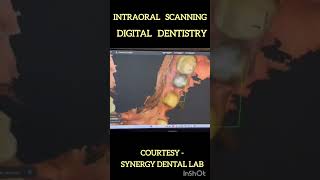 Intraoral Scanning, Digital Dentistry in Sparkle clinic