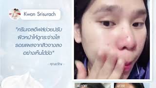 EVES | ผลหลังใช้ \