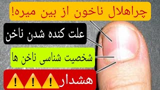 از شکل ناخن ها بفهمید چه بیماری دارید. هشدار ناخن#علاج #ناخن#تشخیص بیماری از روی شکل ناخن