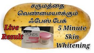 5 Minute Skin Whitening Face Pack in Tamil/சருமத்தை வெண்மையாக்கும் ஃபேஸ் பேக்/ Homemade Face pack