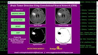 Python Code On Brain Tumor Detection Using CNN Convolutional Neural Network | Python Source Code
