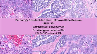 Pathology Resident-led Live Unknown Slide Session (PRLUSS) - Endometrial Carcinomas (Dr. Shi)