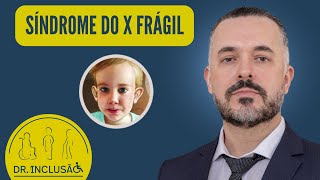 SÍNDROME DO X FRÁGIL: O QUE É? CAUSAS? SINTOMAS? DIAGNÓSTICO? TRATAMENTO? DICAS INCLUSIVAS!