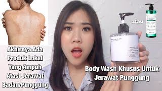 Cara Untuk Mengatasi dan Menghilangkan Jerawat Punggung | Grace and Glow Body Wash Review