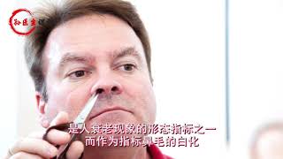 鼻毛变白，是在提示我们身体“变老”？原因或许有3个，不妨了解 1