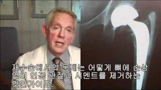 1. ROBODOC® Introduction_Dr. Bargar.wmv